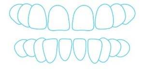 Gaps between teeth and space