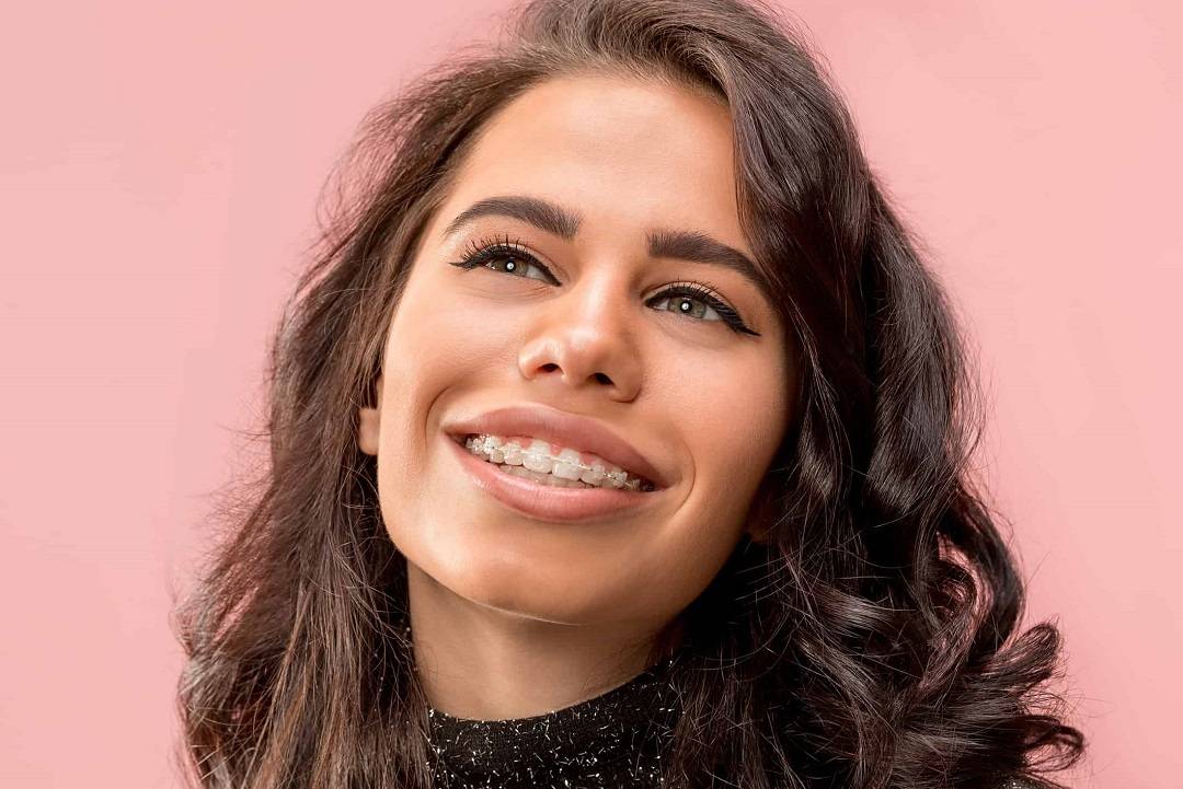 5 Benefits of Invisible Braces or Clear Aligners over Braces