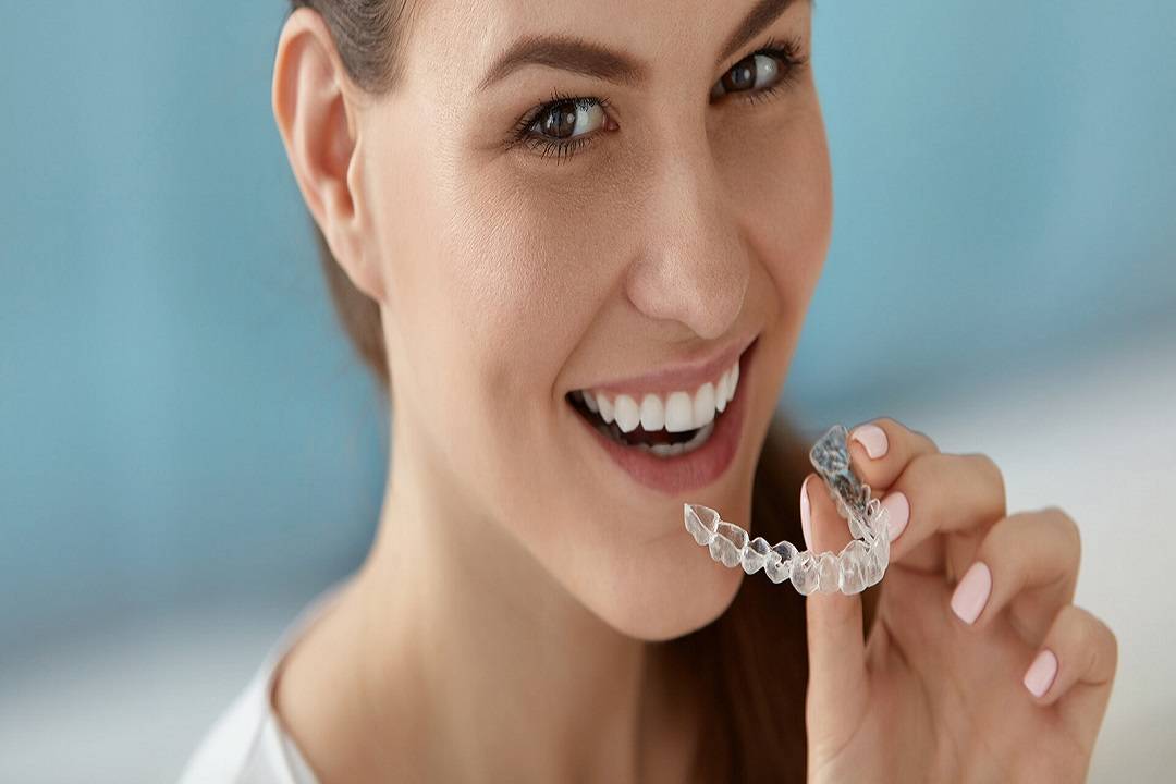 Correcting Crooked Teeth with Clear Aligners SD Align