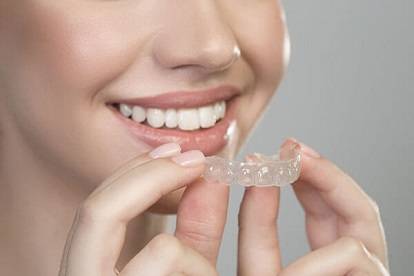 Removing clear aligner