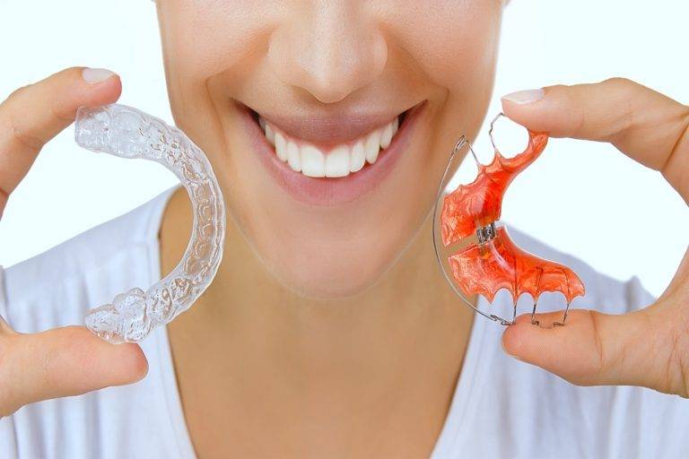 Why Retainers are Essential after Clear Aligners Treatment | SD Align