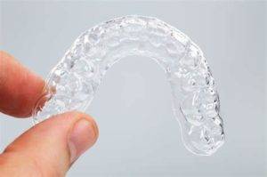 What are clear aligners