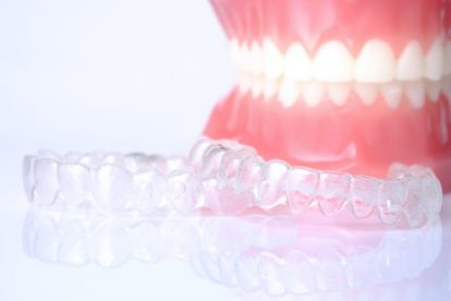 clear_aligners