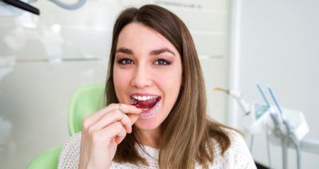 clear aligners in india