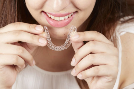 Are invisible braces a feasible option for a million-dollar smile