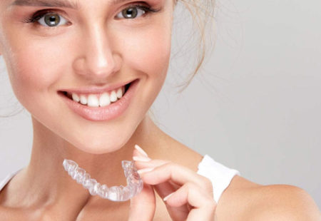 clear aligners