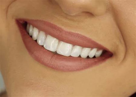 Straight Teeth benefits