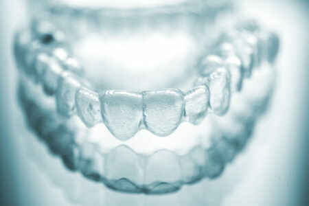 Invisible Teeth Aligners 2