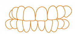 SDalign-Crossbite.png SDalign-Crossbite.png