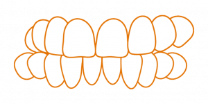 SDalign Crossbite