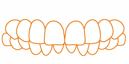 SDalign-Deep-Bite.png SDalign-Deep-Bite.png