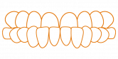 SDalign Underbite