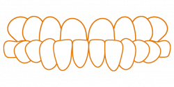 SDalign Underbite